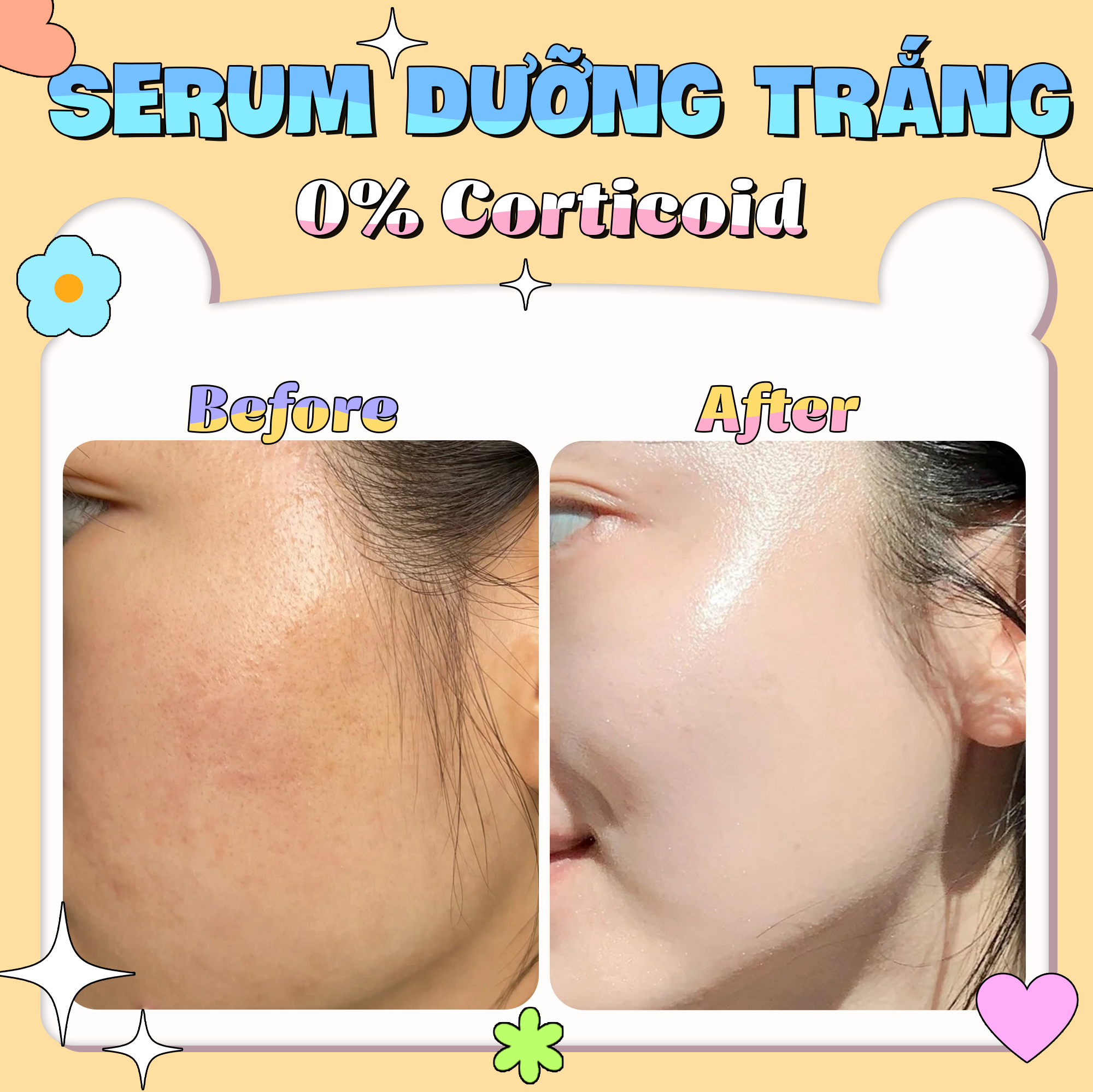 Bộ đôi 2 chai Serum Dưỡng Trắng Da Mờ Thâm Ngừa Mụn GUO 30ml