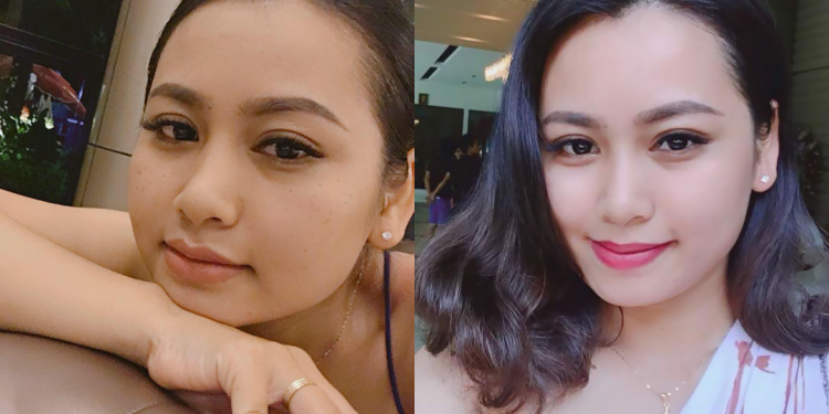 viên uống thực phẩm chức năng trắng da giảm nám từ bên trong của mỹ Spathion White Skin Pharmekal