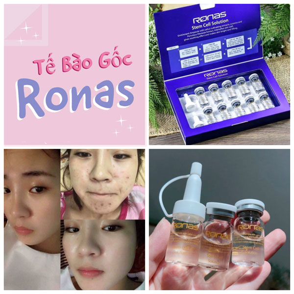 TẾ BÀO GỐC RONAS STEM CELL SOLUTION