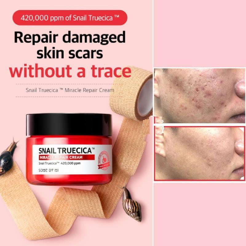 Kem dưỡng ẩm phục hồi, cải thiện sẹo lỏm Some by mi Snail truecica Miracle Repair Cream 60g