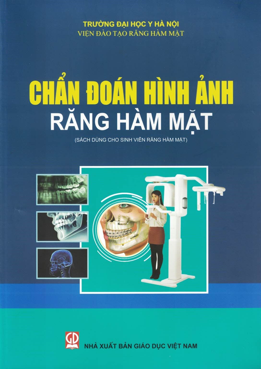 Chẩn Đoán Hình Ảnh Răng Hàm Mặt