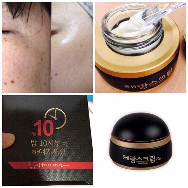 Kem Dongsung Rannce Cream Hỗ Trợ Trị Thâm Nám Tàn Nhan dưỡng trắng da từ Nọc Ong Hàn Quốc
