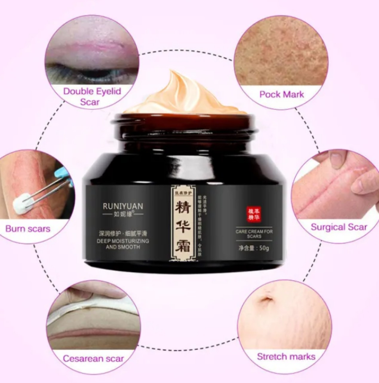 Kem xóa sẹo làm mờ sẹo hàng cao cấp