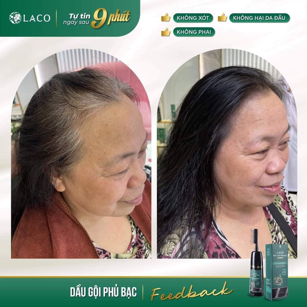 Dầu Gội Phủ Bạc LACO Black Hair, Nhuộm Tóc Đen Thảo Dược Chỉ Sau 9 Phút, Nhuộm Tại Nhà An Toàn 200ml