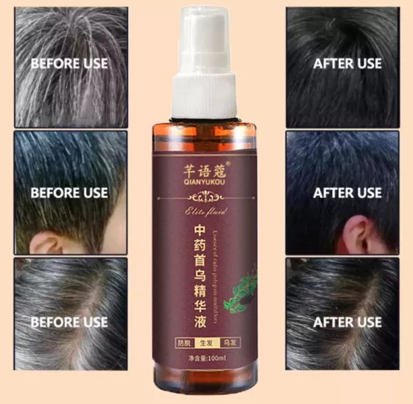 CHAI TINH DẦU XỊT LÀM TÓC ĐEN DƯỠNG TÓC TÓC TRẮNG BIẾN THÀNH TÓC ĐEN ĐẸP HÀNG CHUẨN