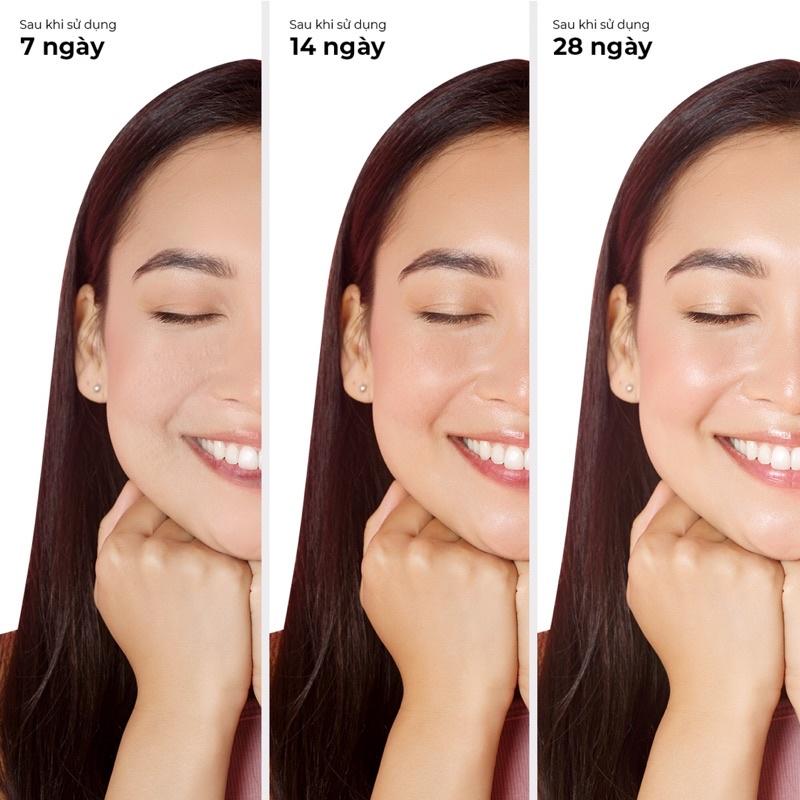 Bộ sản phẩm giảm mụn vùng mặt, ngực và lưng hiệu quả Blissberry