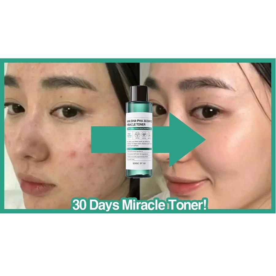 Some by mi AHA BHA PHA 30 days miracle clear foam, toner, serum fulll Size