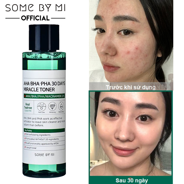 Nước hoa hồng cho da mụn Some By Mi AHA-BHA-PHA 30 Days Miracle Toner 150ml (IP04)