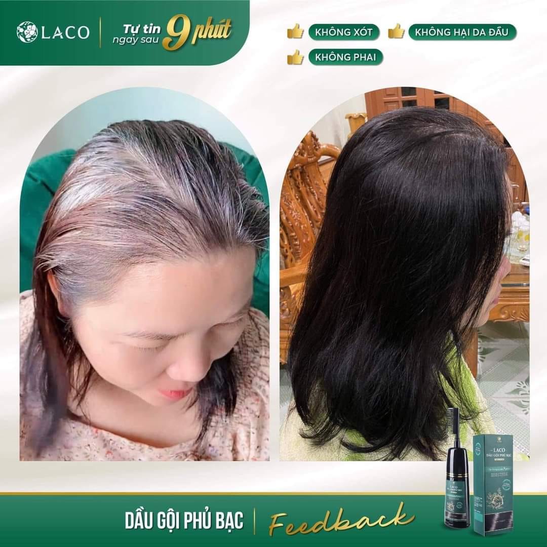 Dầu Gội Phủ Bạc LACO Black Hair, Nhuộm Tóc Đen Thảo Dược Chỉ Sau 9 Phút, Nhuộm Tại Nhà An Toàn 200ml