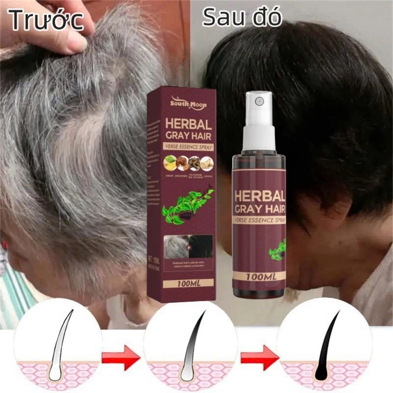 Chai Dưỡng Tóc Đen Tự Nhiên 100ml – Thảo Dược An Toàn Cho Mọi Loại Tóc, Nam Nữ Đều Dùng Được , đèn ốp trần