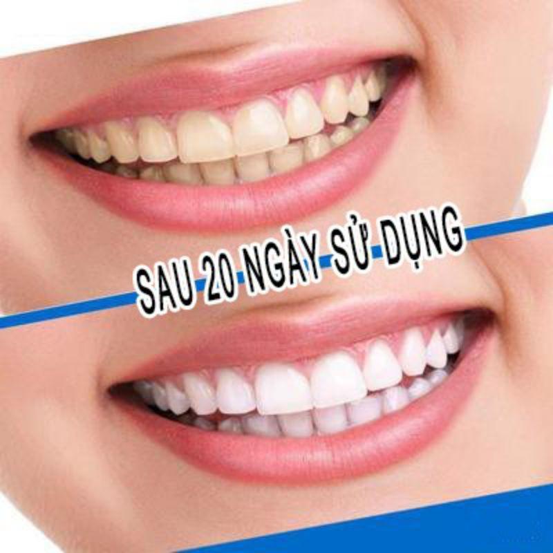Hộp 7 Miếng dán trắng răng tiện lợi 3D White Teeth Whitening Strips