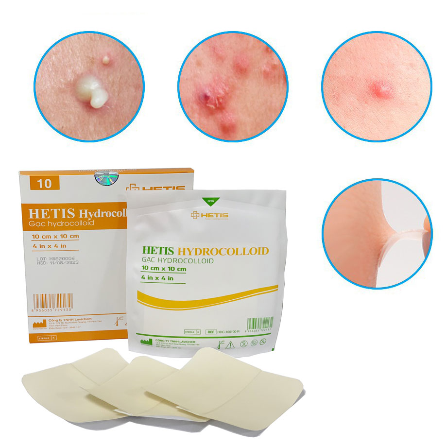 Hộp 10 miếng Gạc Hydrocolloid HETIS size 5x5cm liền thương nhanh không để lại sẹo - Gạc thẩm mỹ chống sẹo, miếng dán liền mụn