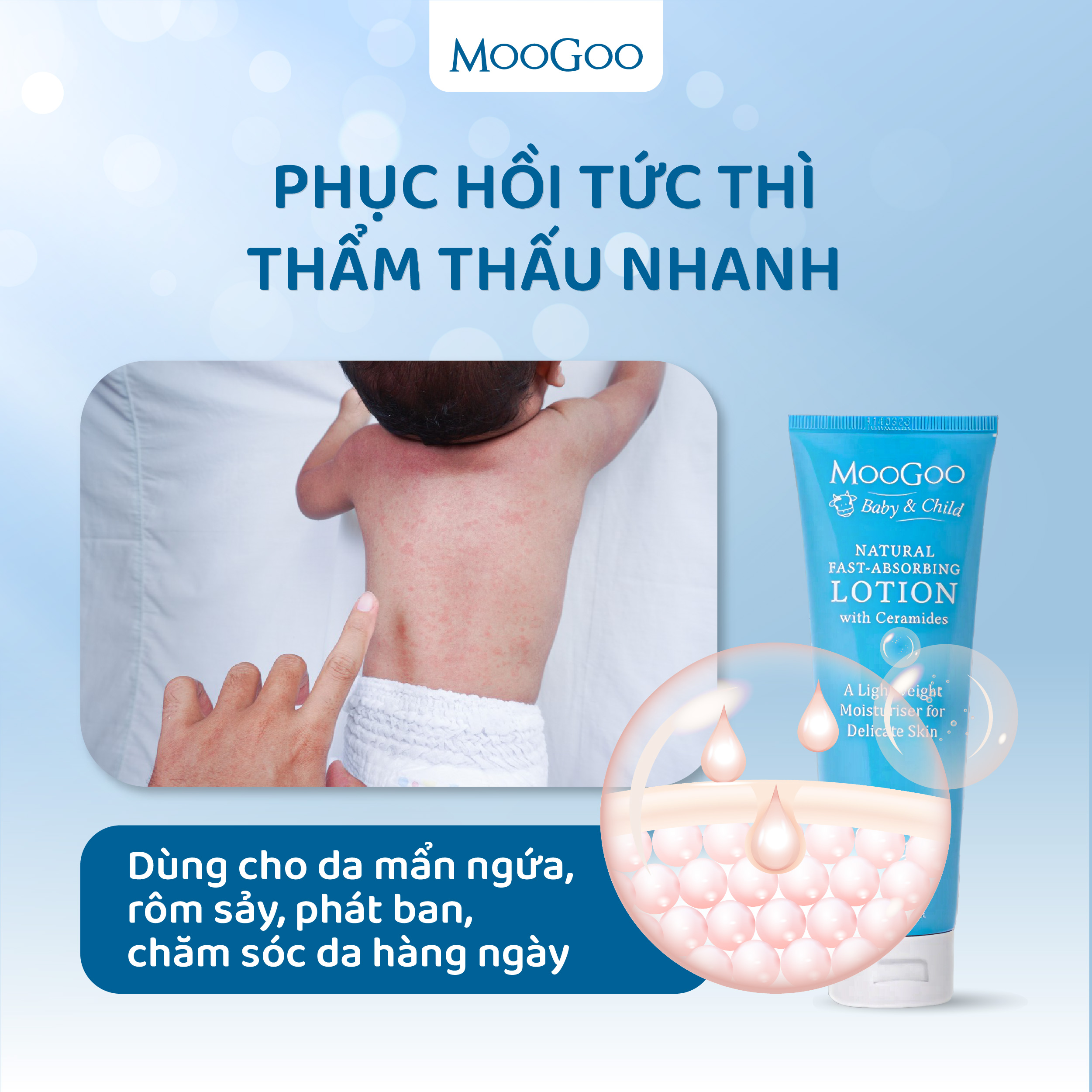 Kem dưỡng ẩm phục hồi khẩn cấp thẩm thấu nhanh chứa Ceramides cho da nhạy cảm, rôm sảy, chàm sữa, viêm cơ địa - Moogoo