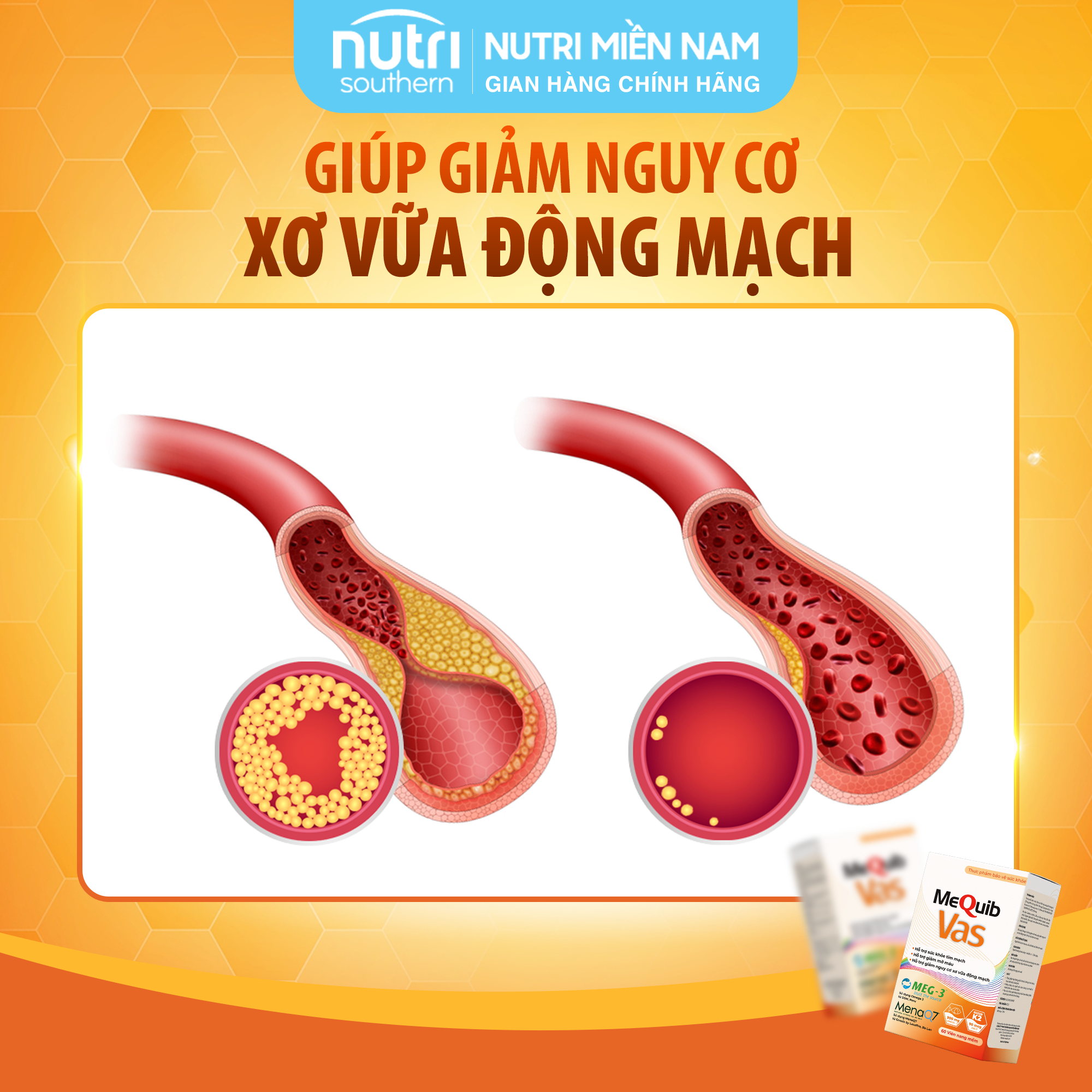 MEQUIB VAS Hỗ Trợ Ngăn Lão Hóa Tim Mạch, Ngừa Xơ Vữa Động Mạch