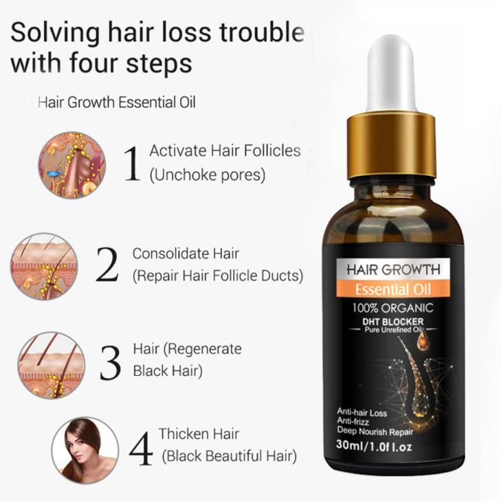 Tinh dầu gừng chăm sóc tóc chắc khỏe Hair Growth Essential Oil 30ml