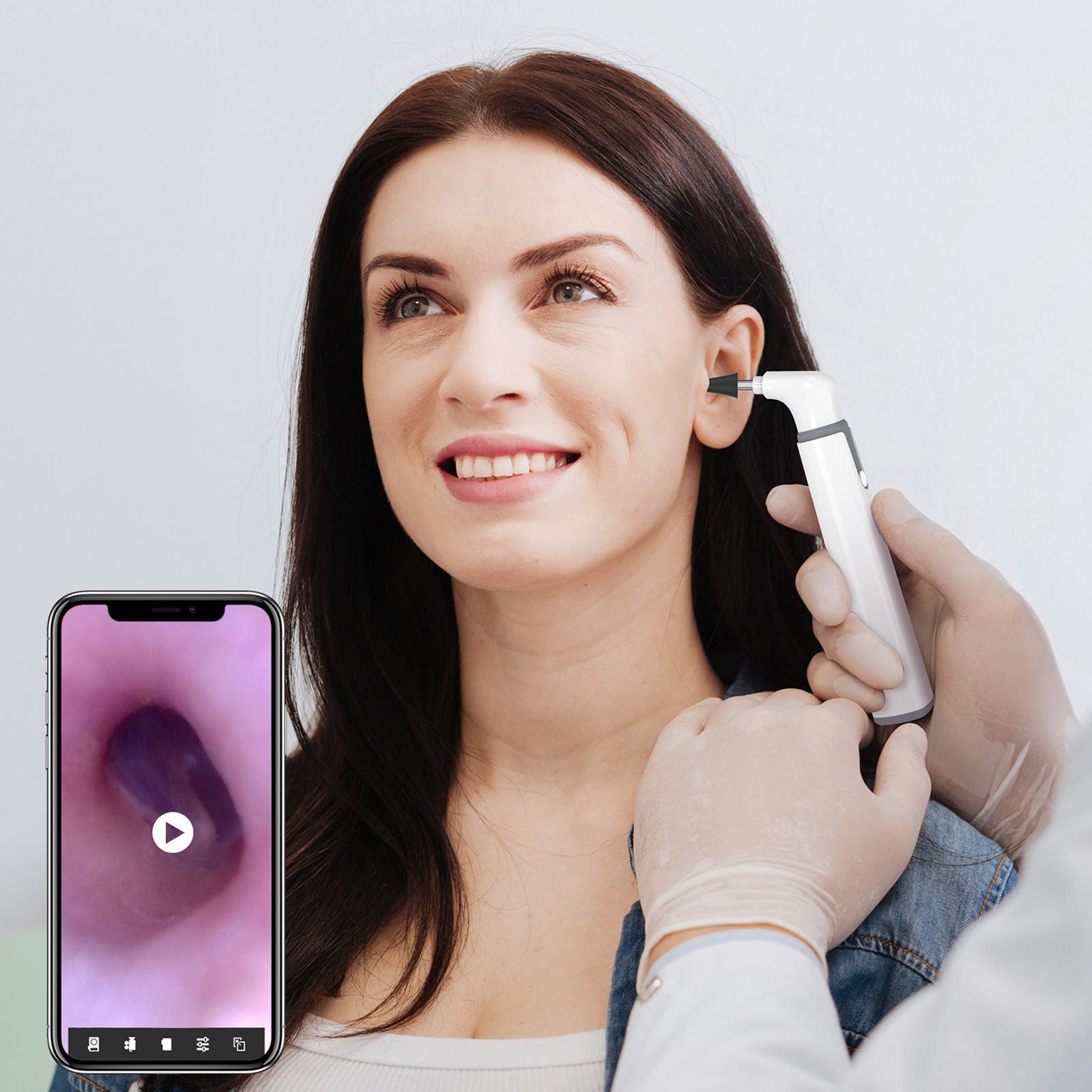 WiFi Wireless with Camera Ear Cleaner Endoscope for Kids Adults