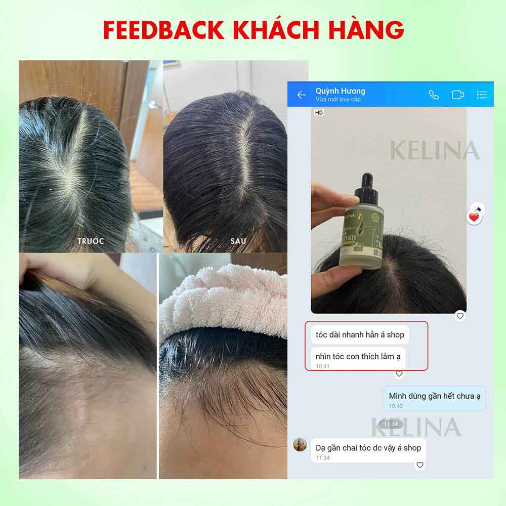 Serum Cao Cấp Kích Thích Mọc Tóc, Ngăn Ngừa Gãy Rụng, Làm Dày Và Chắc Khỏe Tóc Kelina Size Mini 10ml