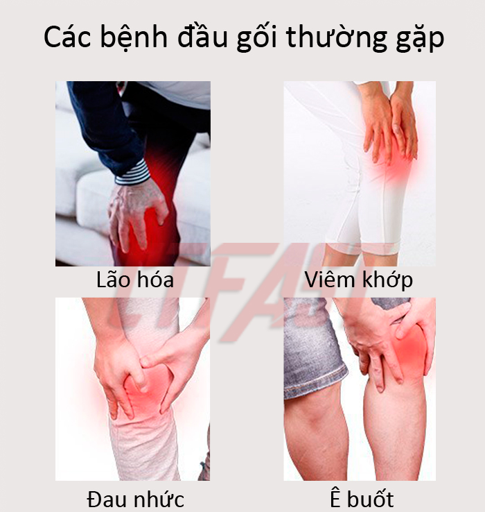 Máy massage đầu gối không dây thông minh CTFAST: Công nghệ mát xa rung kết hợp nhiệt hồng ngoại, hỗ trợ điều trị đau khớp gối, pin sạc 6000mAh, chất liệu dễ dàng vệ sinh