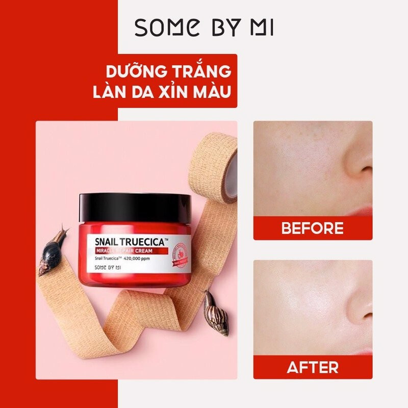 Bộ Sản Phẩm Dưỡng Da Phục Hồi Some By Mi Snail Truecica Miracle Repair