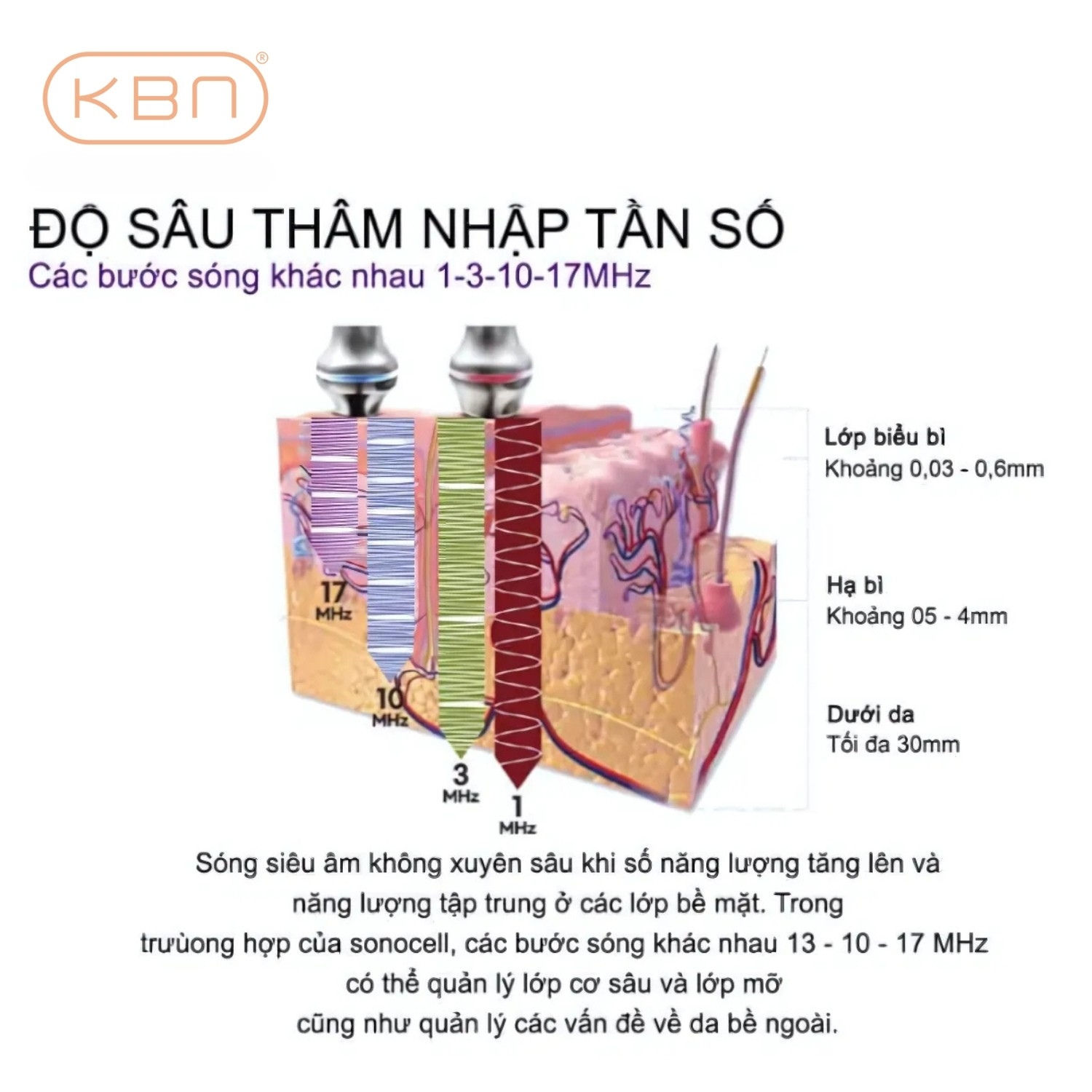 Máy Siêu Âm Đa Tầng SONOCELL Hàn Quốc Đẩy Dưỡng Chất Vào Da, Nâng Cơ, Xóa Nhăn, Dưỡng Trắng