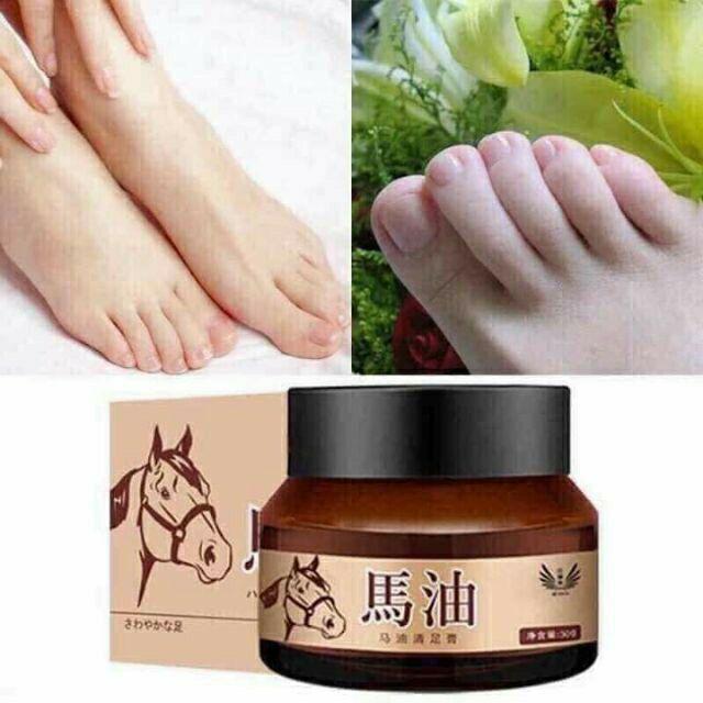 Kem đầu ngựa bôi nứt gót chân