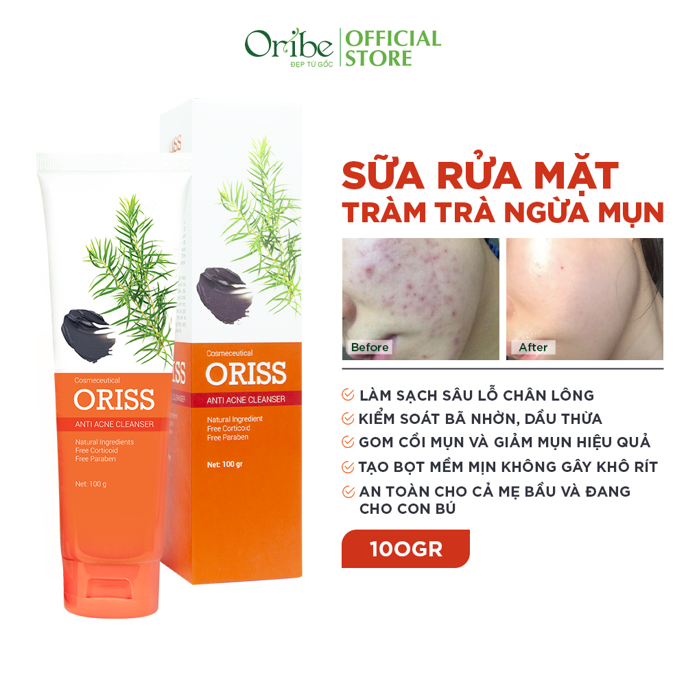 Sữa Rửa Mặt Tạo Bọt Ngừa Mụn Oriss 100g - Chuyên Dành Cho Da Mụn