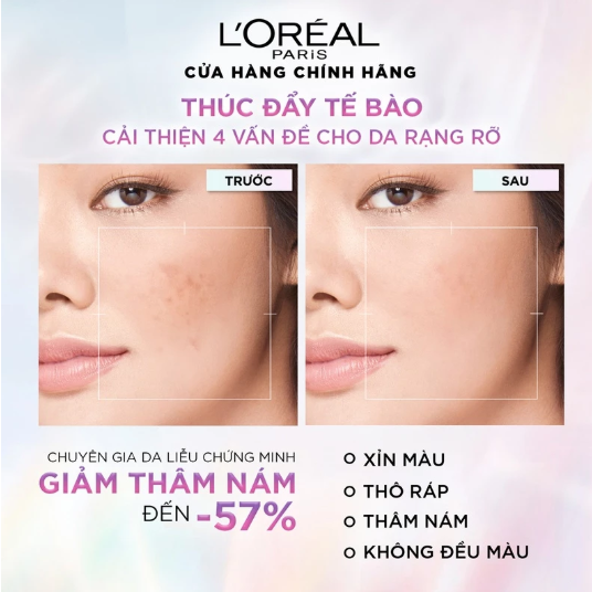 Kem Dưỡng L'Oreal Sáng Mịn Mờ Thâm Nám 50ml
