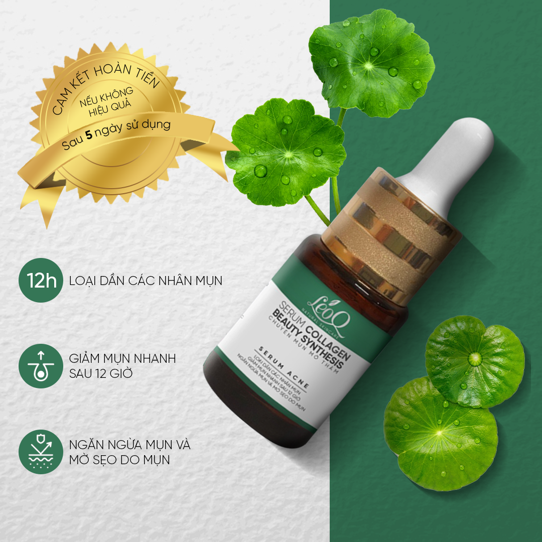 Serum sạch mụn LeoQ tinh chất rau má giảm mụn xuất hiện cấp ẩm ngăn chăn vi khuẩn 15ml L51