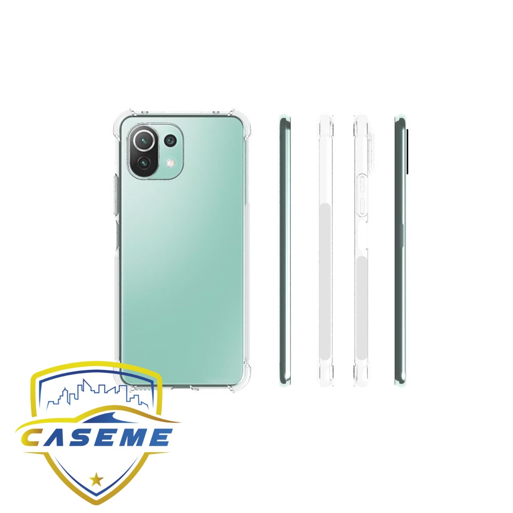 Ốp lưng dành cho Xiaomi Mi 11 Pro dẻo trong chống sốc