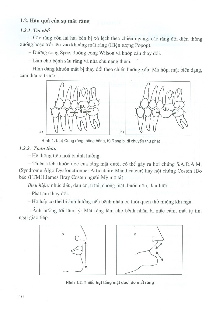 Phục Hình Răng Tháo Lắp (Dùng Cho Sinh Viên Răng Hàm Mặt)