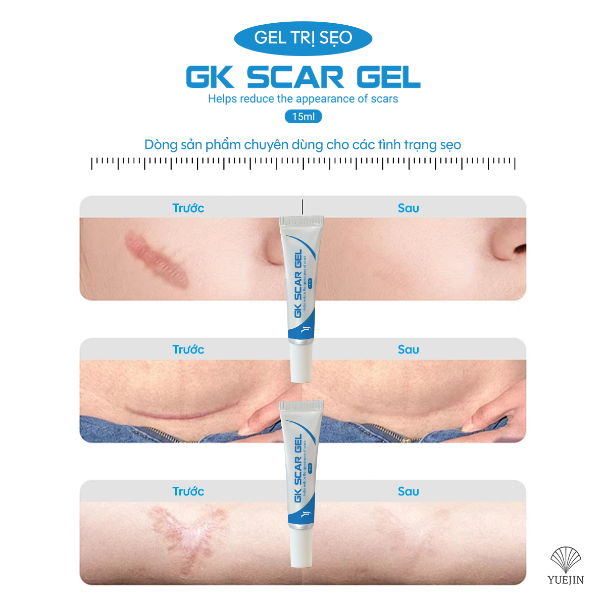 Gel trị sẹo GK SCAR GEL lấp đầy Sẹo Rỗ, Sẹo Lõm, làm phẳng Sẹo Lồi, Sẹo Thâm 15ml của Yuejin