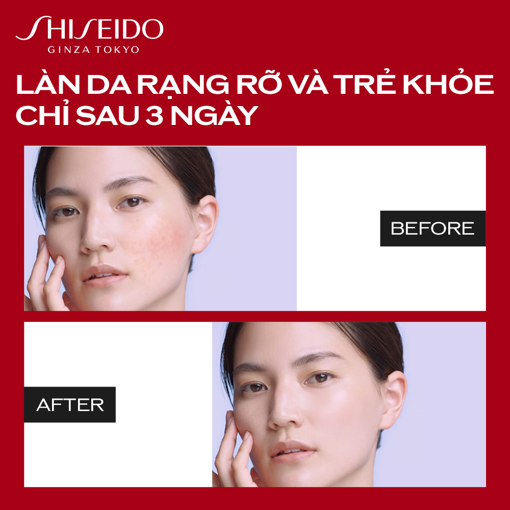 Tinh chất dưỡng da Shiseido Ultimune Power Infusing Concentrate 30ml