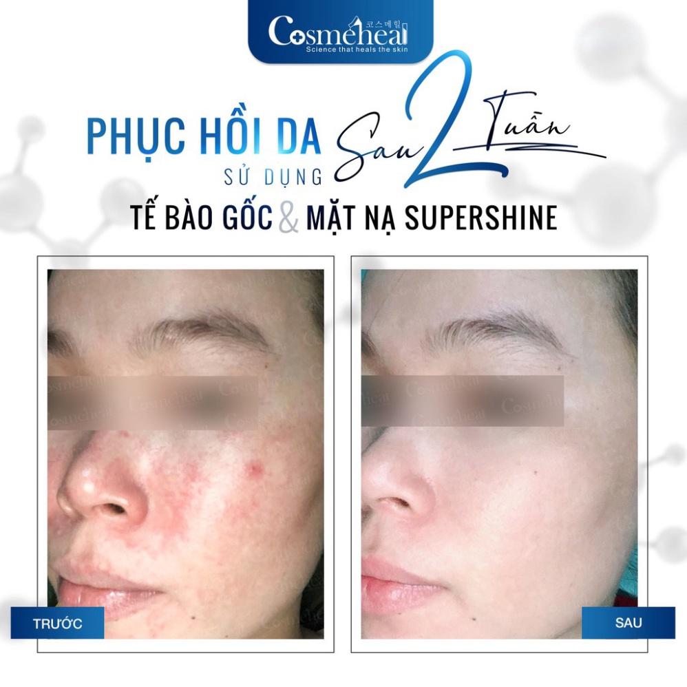 Tế bào gốc căng bóng da COSMEHEAL SuperShine Ampoule