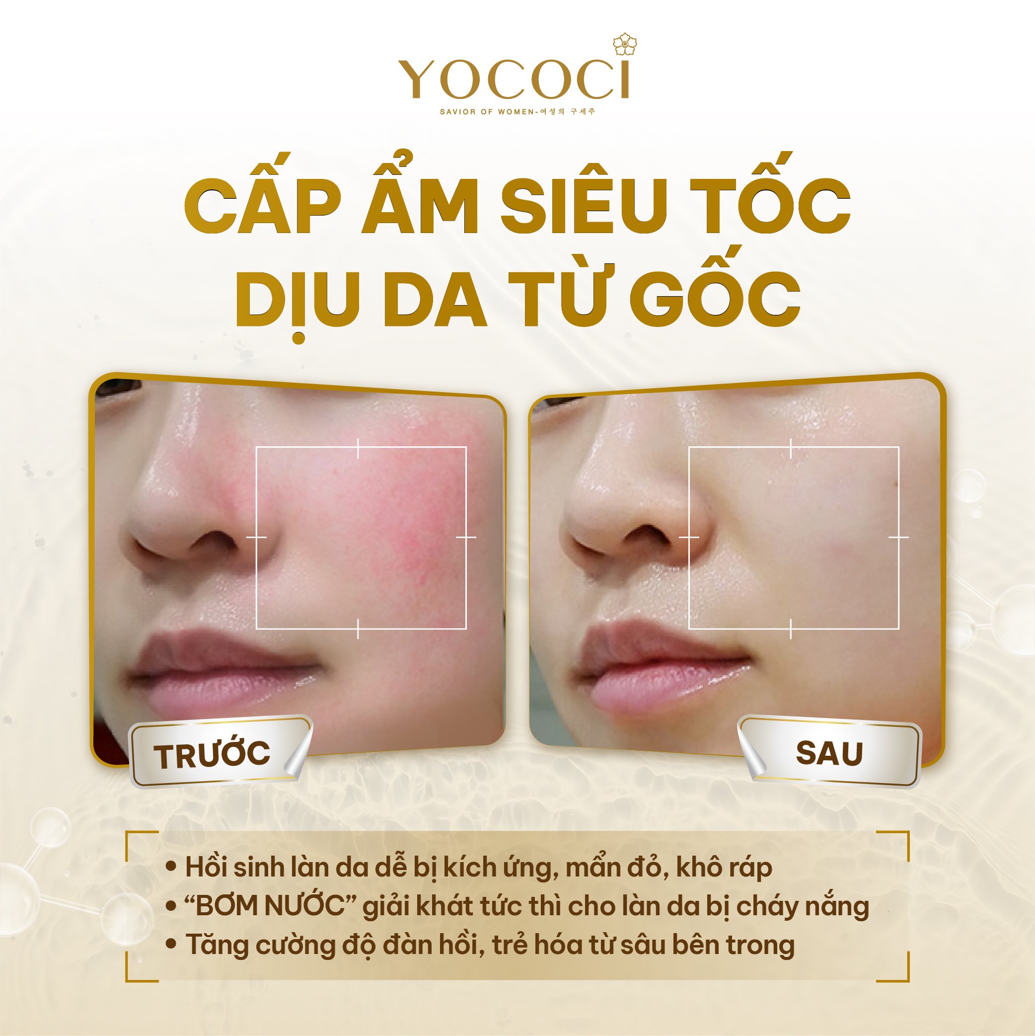 Mặt nạ ngủ Yococi giúp bổ sung dưỡng chất vitamin, dưỡng trắng, ngăn ngừa quá trình lão hóa da Perfect Sleeping Mask 30g