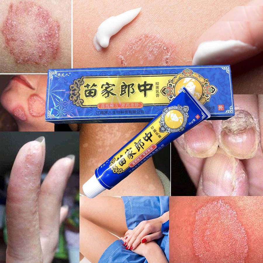 Kem bôi hỗ trợ điều trị ngứa, vảy nến, á sừng, nứt chân 15 gram