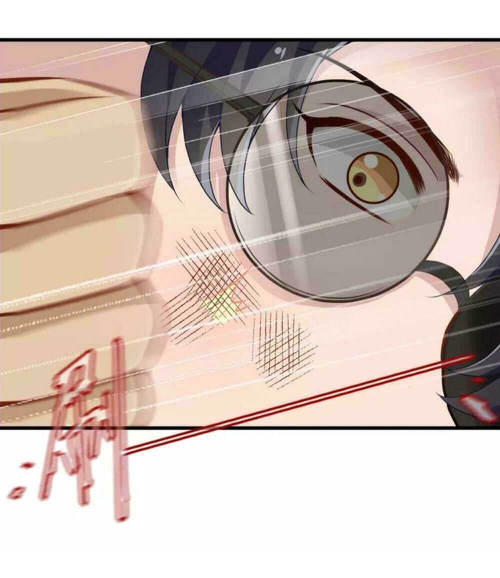 mệnh trung khuyết quân chapter 1.2 20