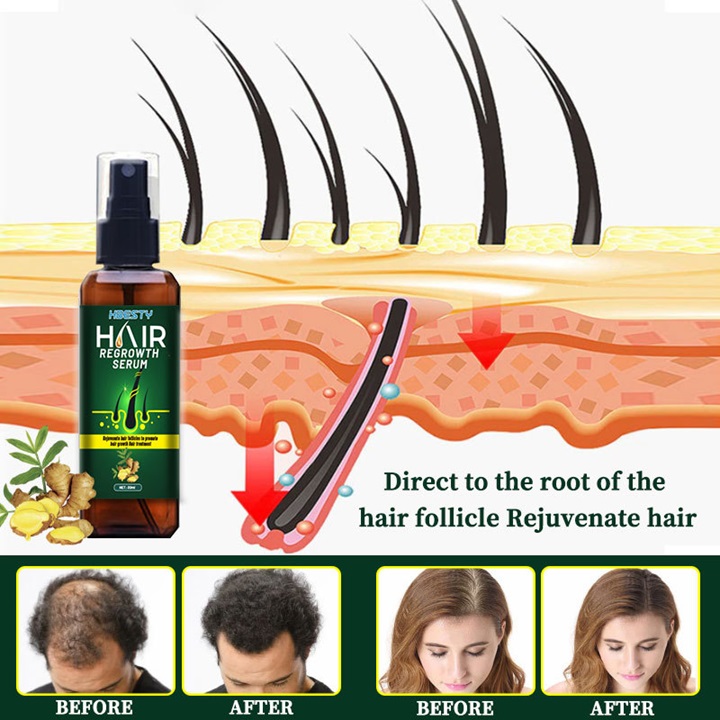 Serum dưỡng mọc tóc, giúp tóc mọc nhanh, nhiều và dày, sợi tóc đen bóng xuất xứ Nhật Bản – Mã số 1230