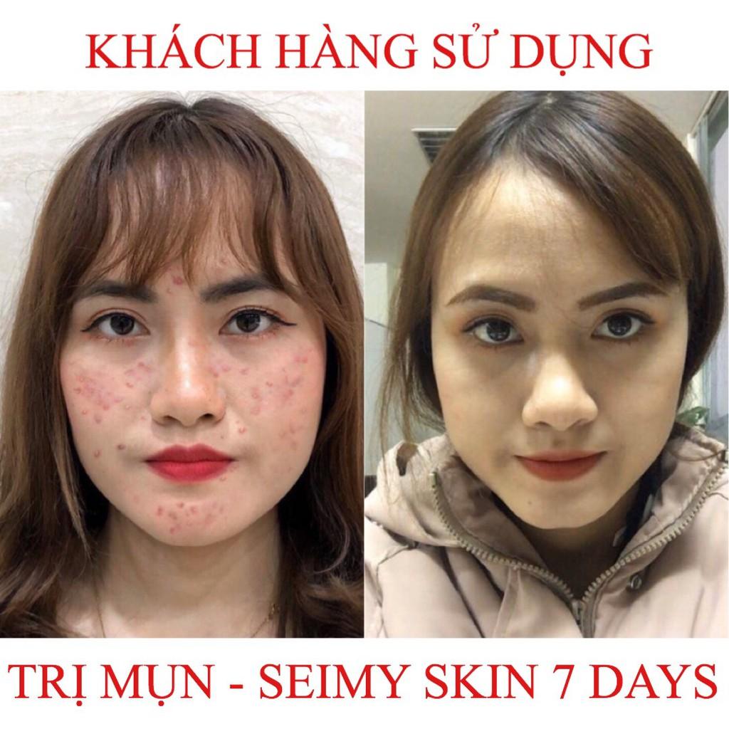 Serum ngừa mụn, giảm mụn thâm rỗ Seimy - Skin 7 Days - Công dụng 5 trong 1 hiệu quả sau 7 ngày