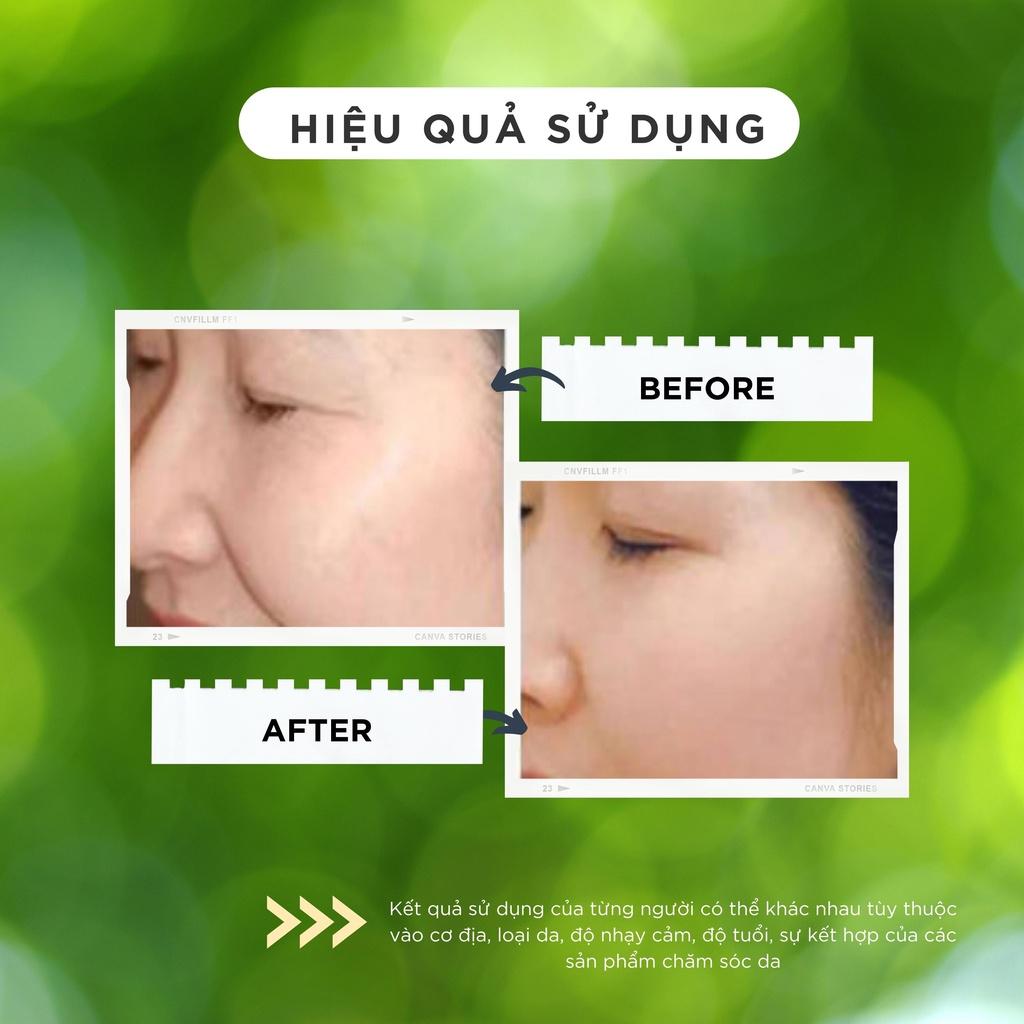 Kem dưỡng giảm thâm nám tàn nhang, nâng tone da mịn màng trắng hồng TOPCHARM 30g