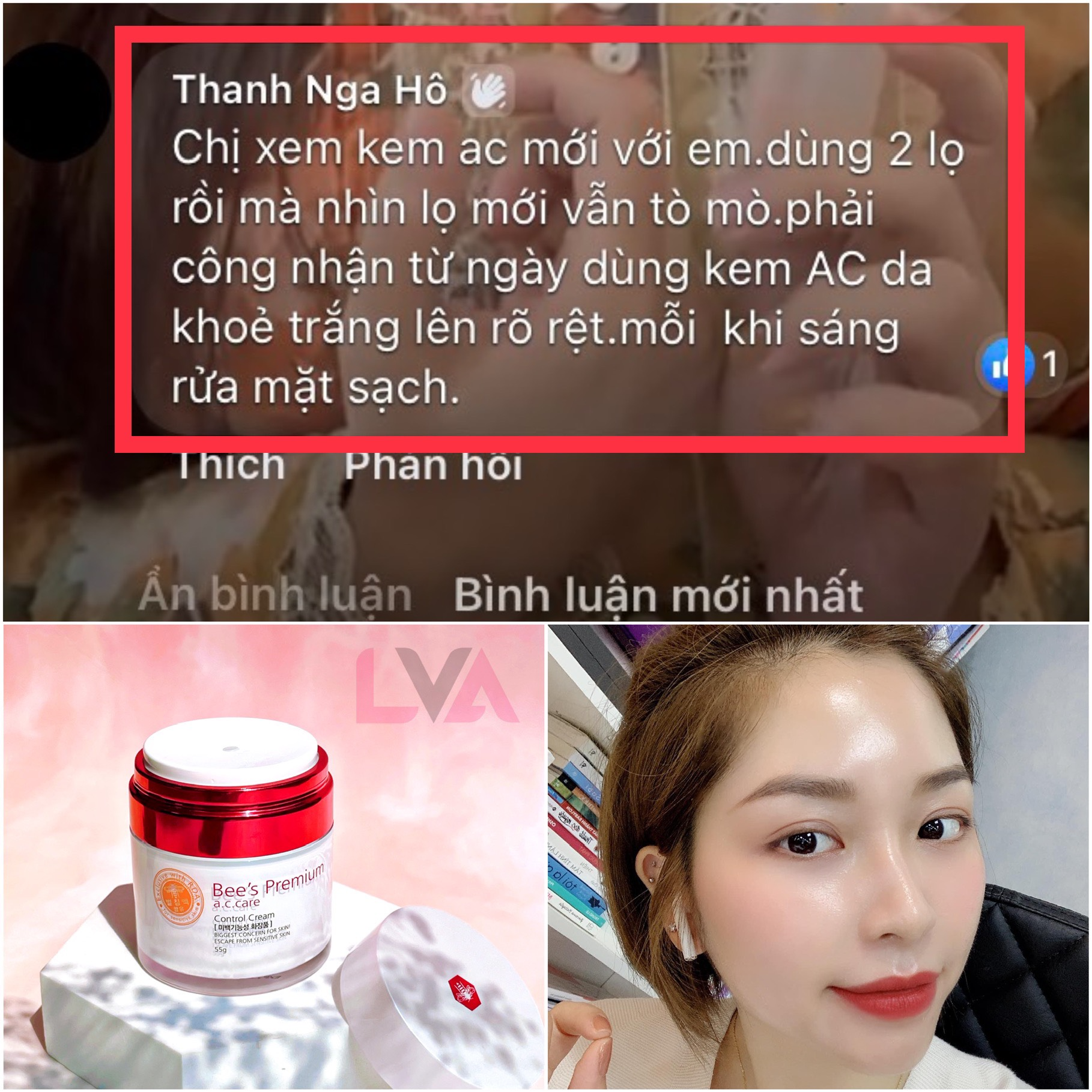 Kem dưỡng ngừa mụn, mờ thâm nám từ nọc ong AC Care Bee's Premium Control Cream