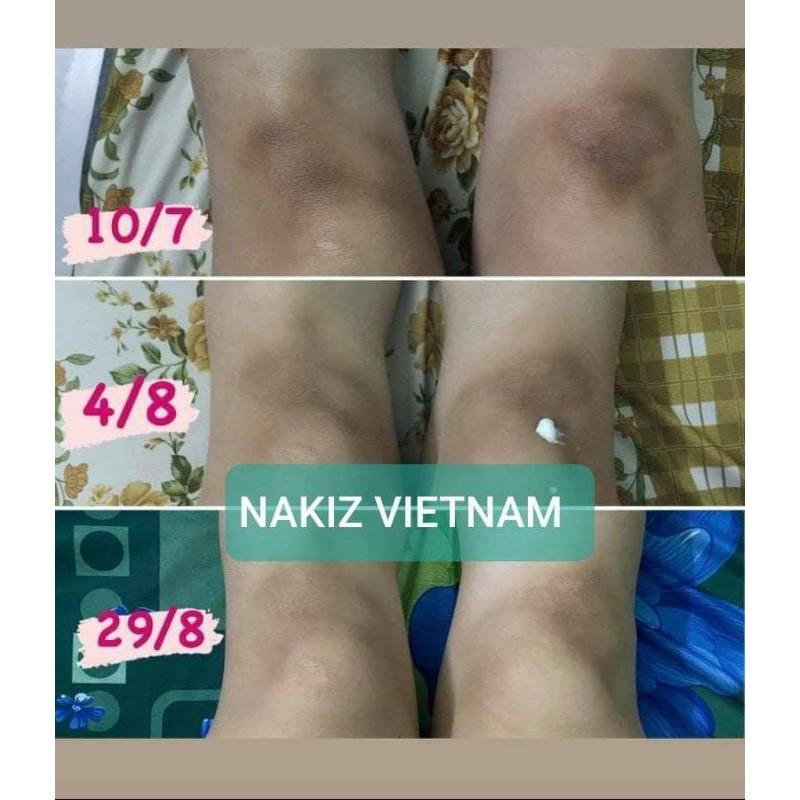 2 TUÝP NAKIZ LIVELY BUTT Kem thoa thâm Mông, Bẹn, Nách, Lưng, Nh.ũ hoa, Đầu gối, Cùi chỏ.... Thái Lan