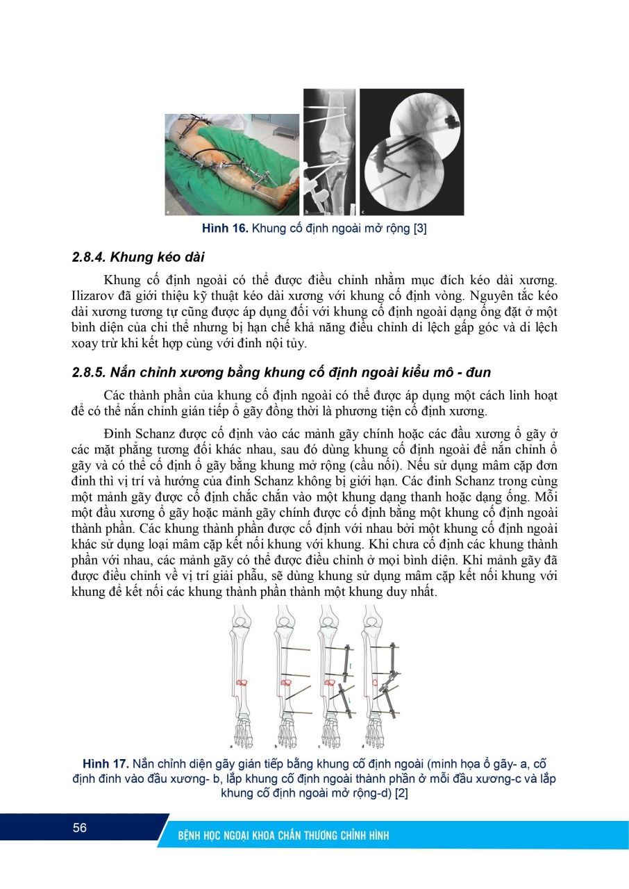 Sách - Bệnh học ngoại khoa Chấn thương chỉnh hình (Tái bản 2024)