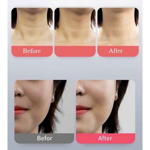 Máy Massage kéo căng bằng điện siêu âm, dụng cụ nâng cơ, giảm nhăn, tái tạo collagen chống chảy xệ làm đẹp da chuyên vùng cổ, tráng và mặt + Tặng Máy Massage Cầm Tay Nâng Cơ Mặt 3D Giảm Stress