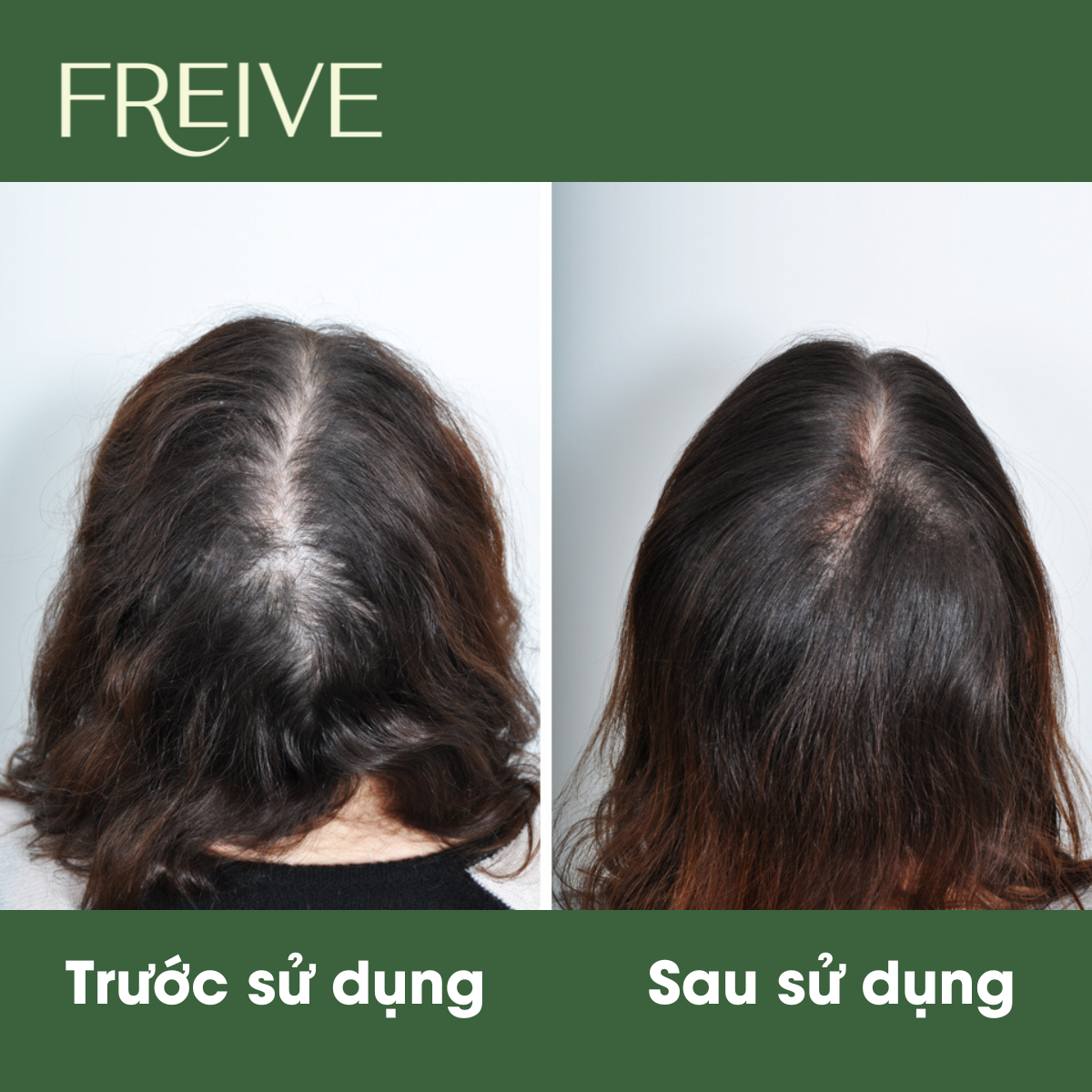 Dầu gội thảo dược Freive hương bồ kết giảm rụng tóc giúp mọc tóc đen mượt tóc 300ml