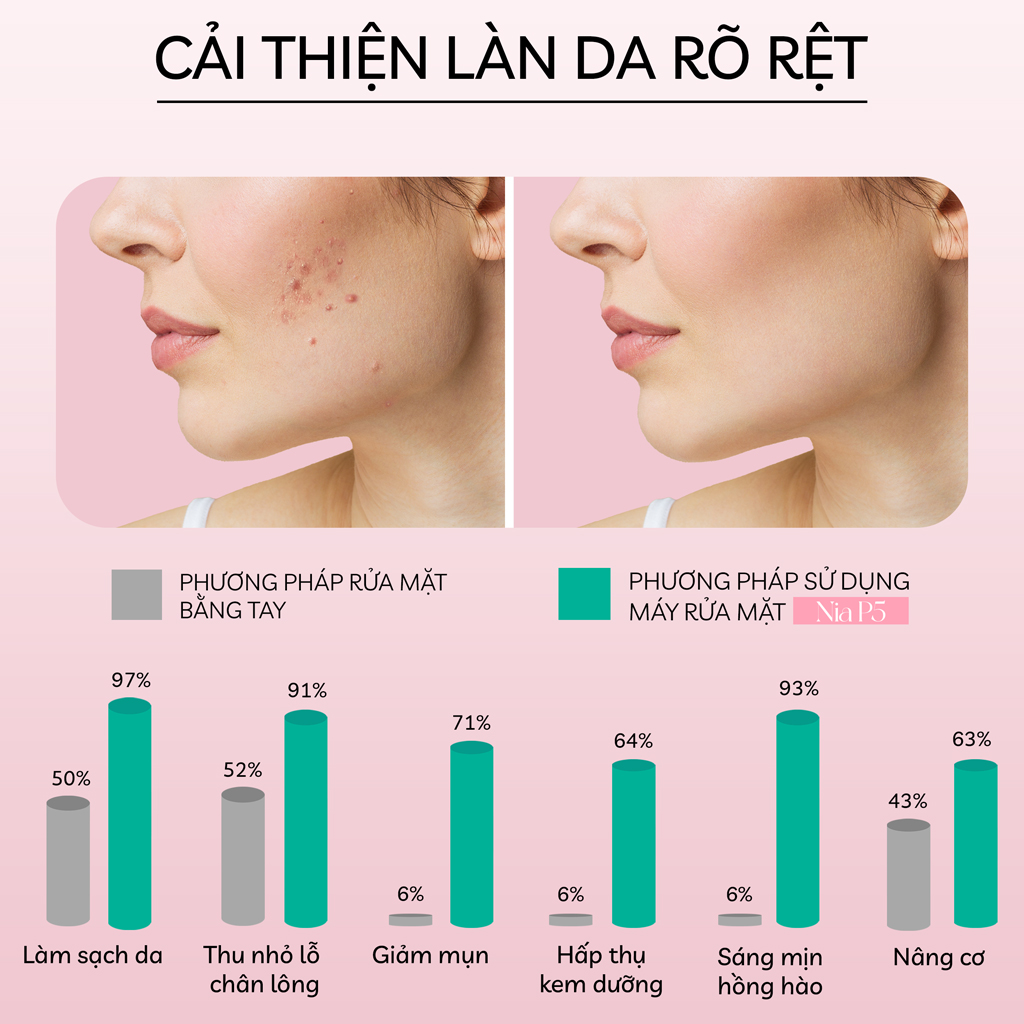 Máy Rửa Mặt Mini Cầm Tay Crénot Beauté Nia P5 Chính Hãng Sử Dụng Sóng Âm Và Silicone Siêu Mềm Sạch Sâu Bụi Bẩn Trang Điểm Ngừa Mụn - Máy Rửa Mặt Massage Mát xa Matxa Tốt Chăm Sóc Da Dầu Mụn Nhạy Cảm Cho Nam Nữ