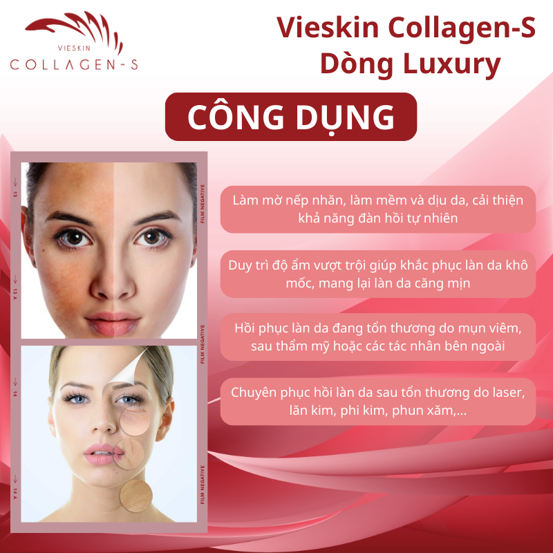 Tinh Chất Vieskin Collagen S-Luxury Cao Cấp Tái Tạo Trẻ Hóa Da, Ngăn Ngừa Lão Hóa, Collagen Tươi Cao Cấp