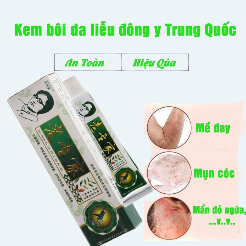 Kem Bôi Nứt Nẻ Á Sừng Tay Chân Ngoài Da