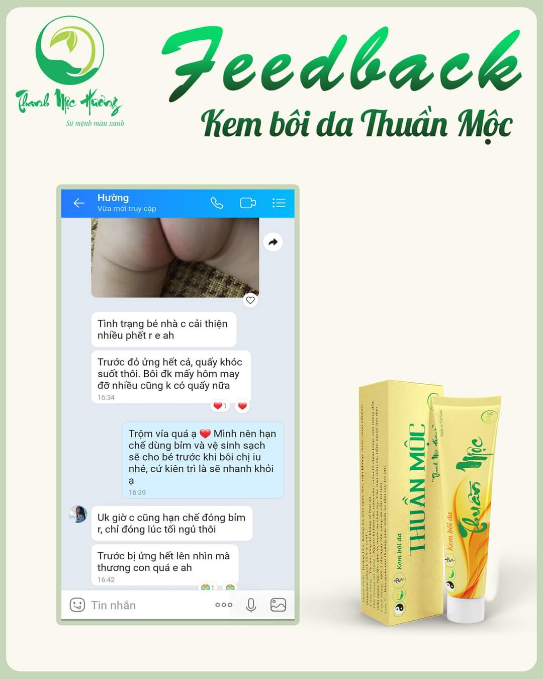 Combo kem bôi da thuần mộc ngừa rôm sảy chàm sữa nấm da đầu Thanh Mộc Hương 16g