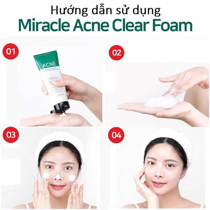 Bộ 4 Sản Phẩm Ngăn Ngừa Mụn Giảm Thâm Some By Mi AHA-BHA-PHA 30 Days Miracle (Sữa rửa mặt 100ml + Toner 150ml + Serum 50ml + Cream 60g) Tặng 1 Mặt Nạ Sexylook