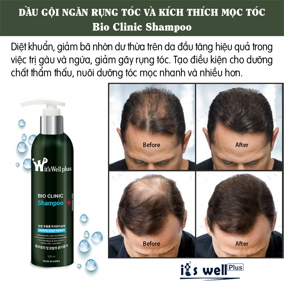 Dầu Gội Ngăn Rụng Tóc Và Hỗ Trợ Mọc Tóc It'S Well Plus Bio Clinic Shampoo 300ml